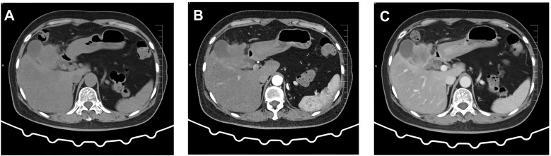 Figure 1