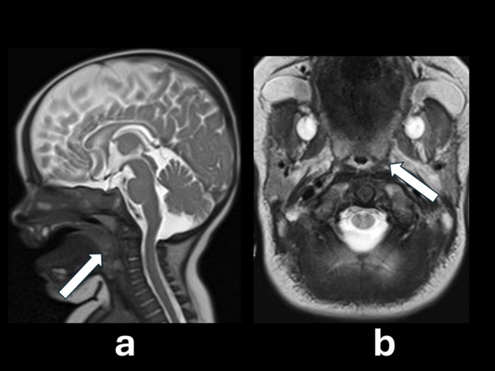 FIGURE 3