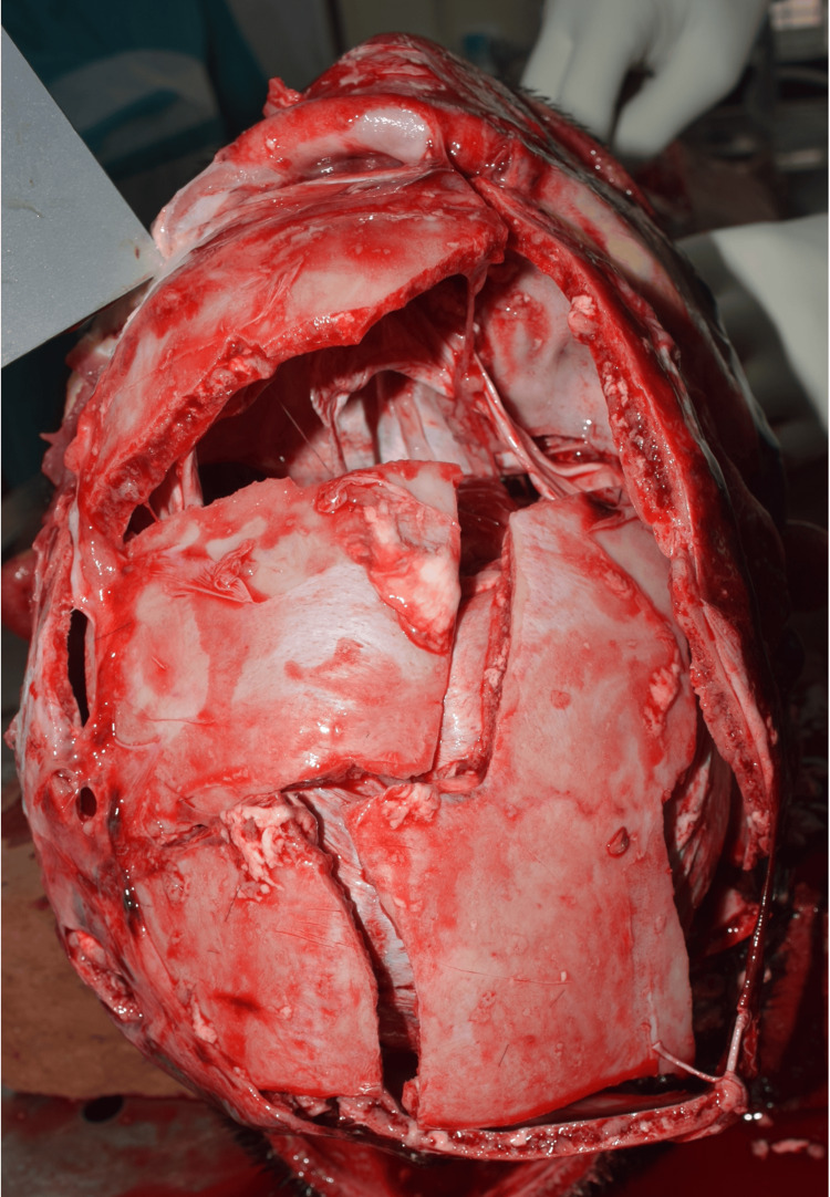 Figure 4