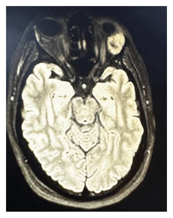 FIGURE 2