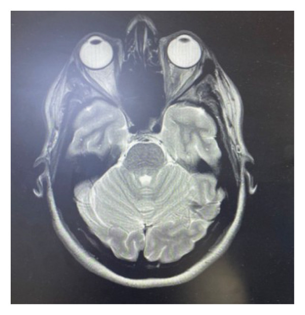 FIGURE 3