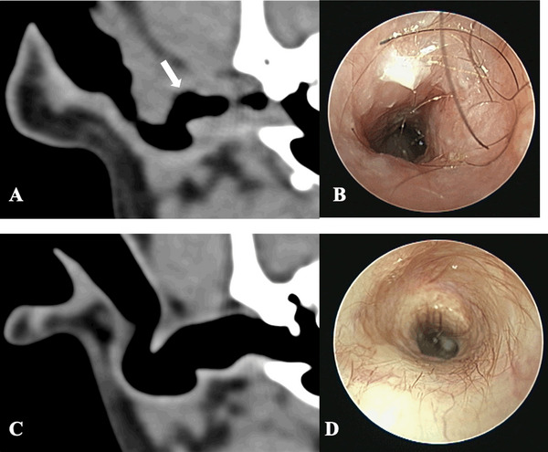 FIGURE 3