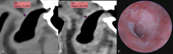 FIGURE 4