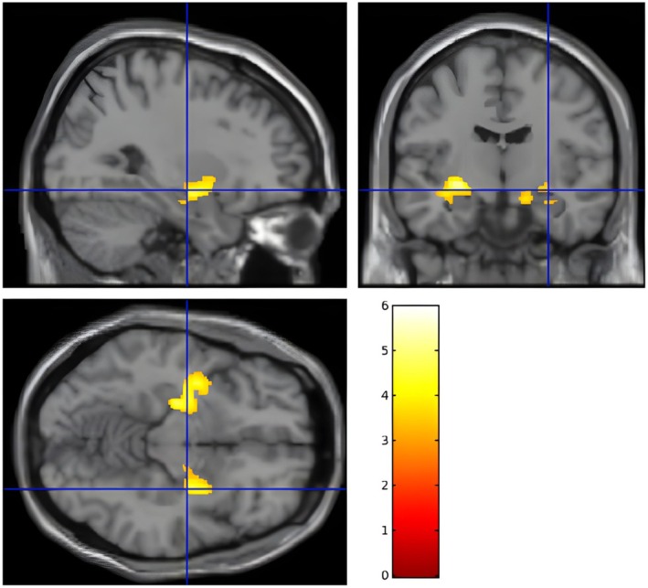 FIGURE 1