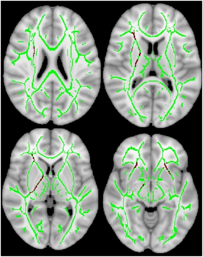FIGURE 2