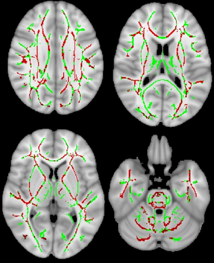 FIGURE 3