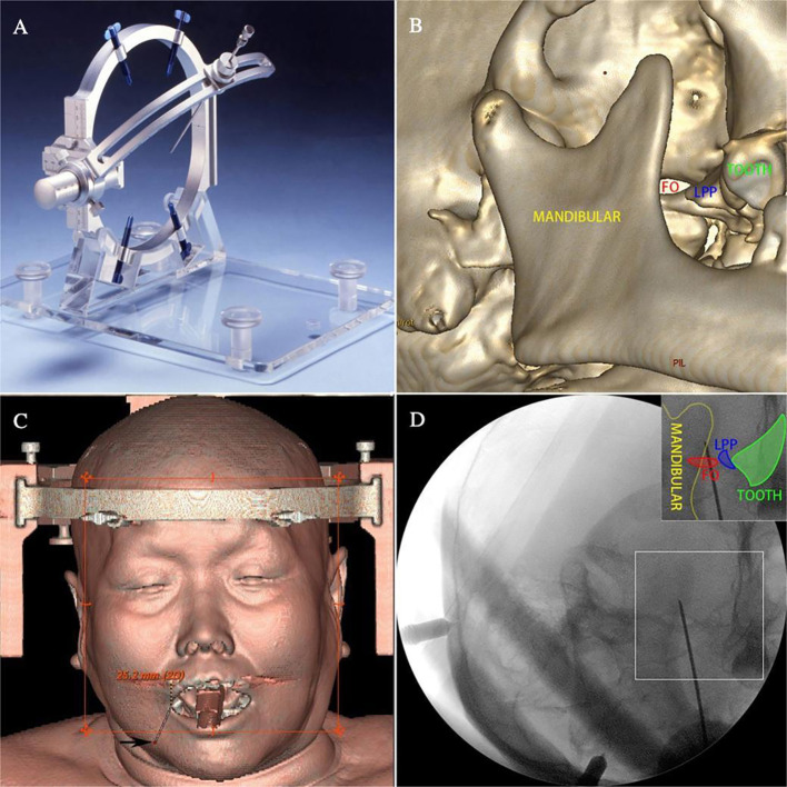 Figure 1