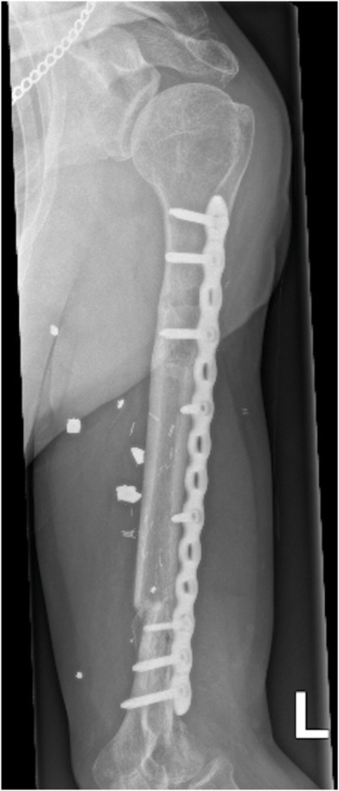 Figure 5