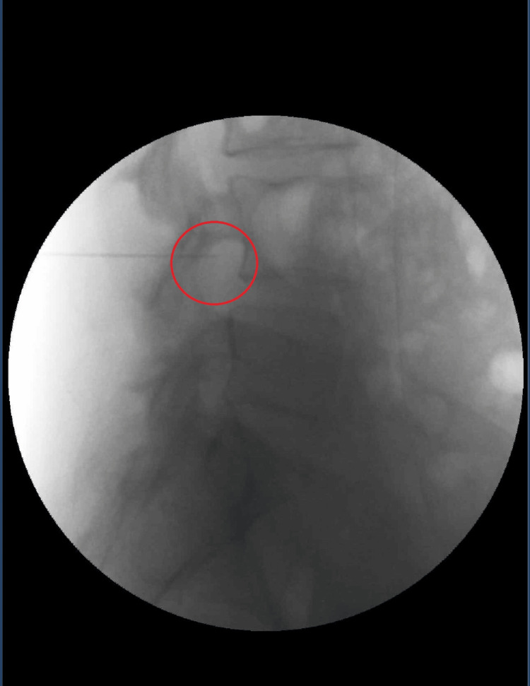 Figure 2
