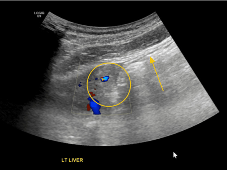 Figure 11