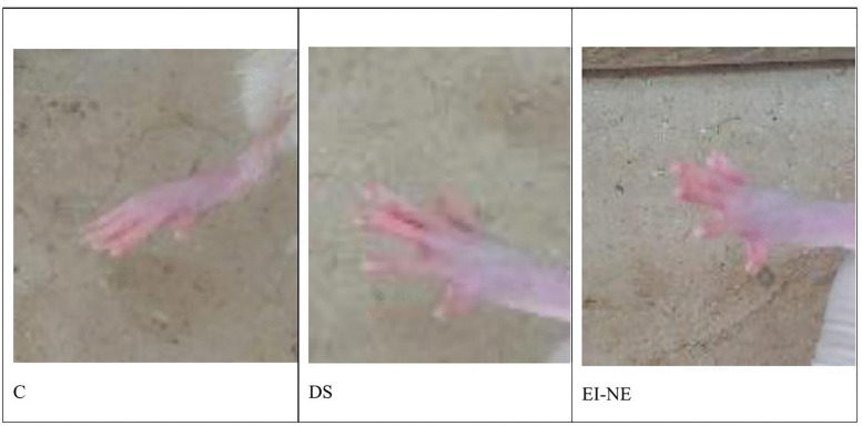 Figure 14