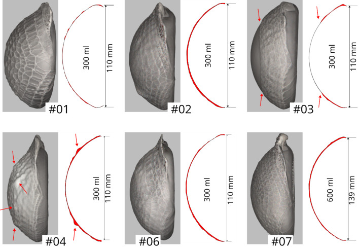 Figure 14