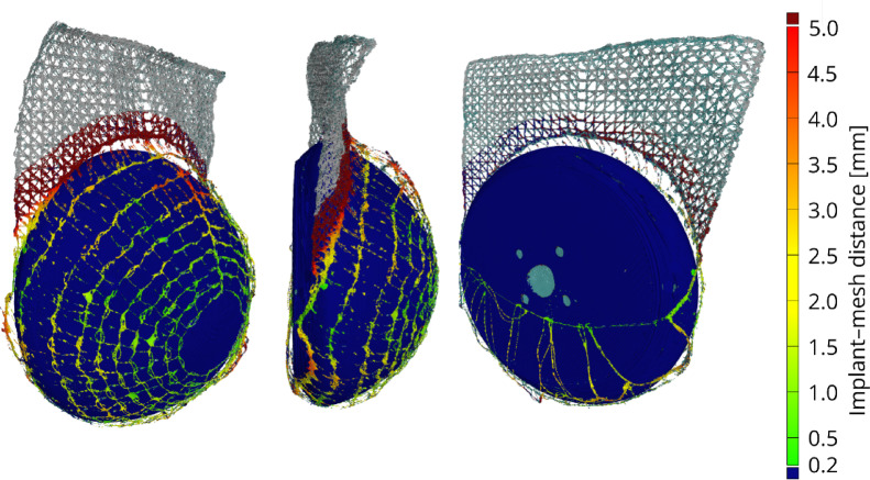 Figure 15