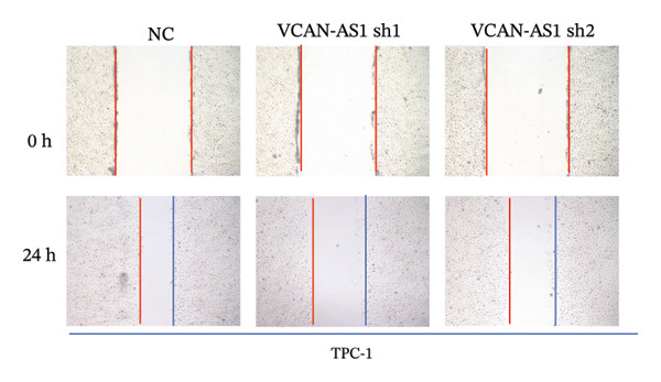 Figure 26