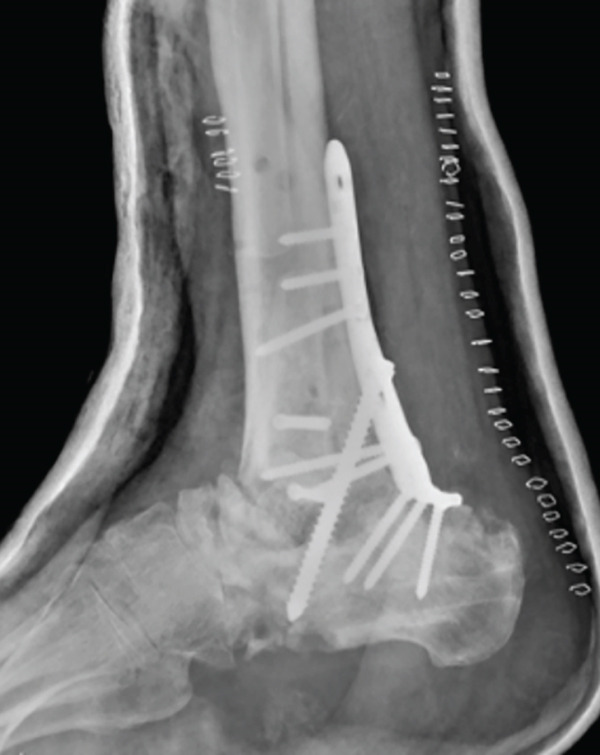 Figure 4