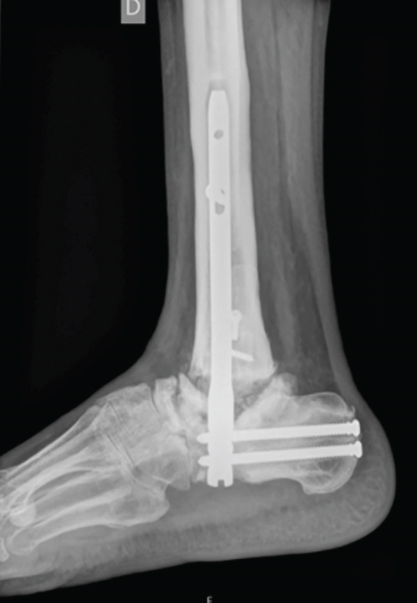Figure 5