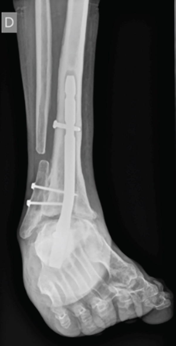Figure 6