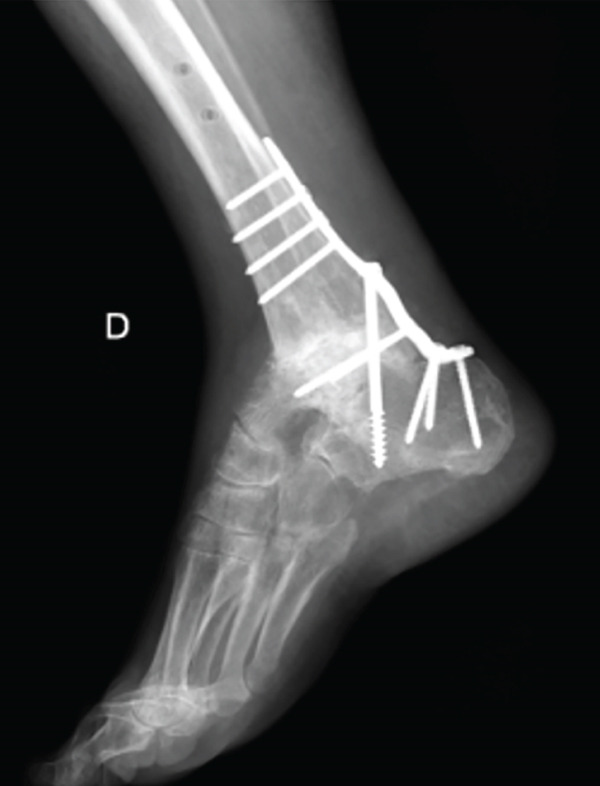 Figure 9