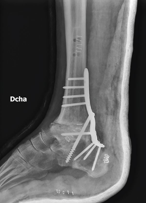 Figure 10