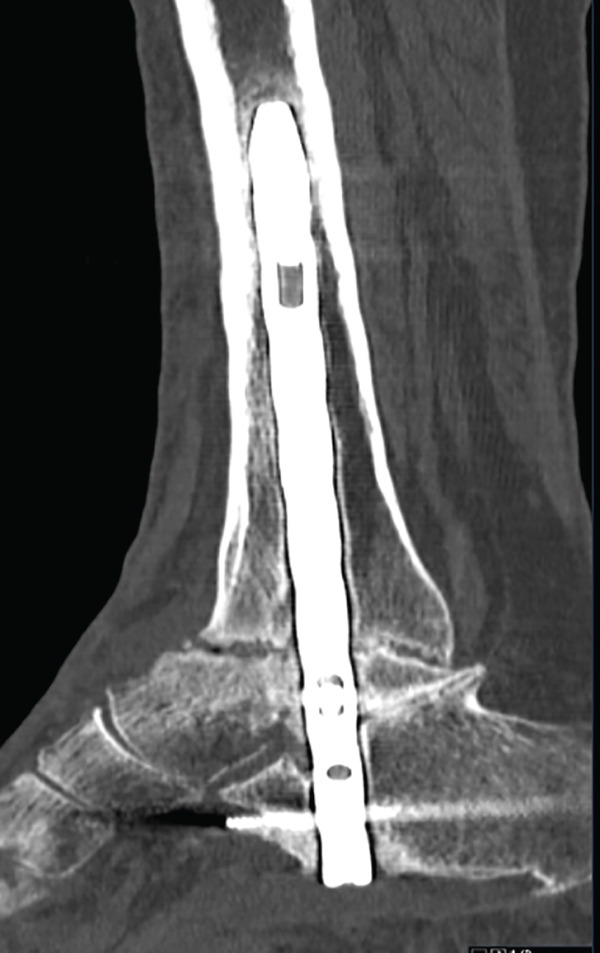 Figure 15