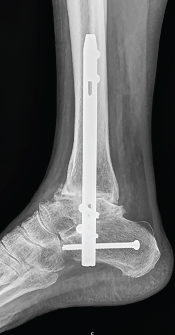 Figure 17