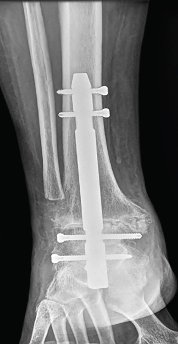 Figure 18
