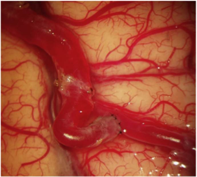 Figure 10