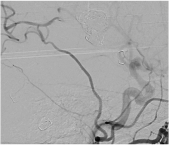 Figure 11