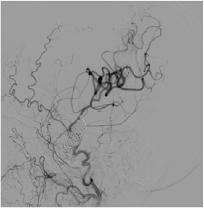 Figure 12