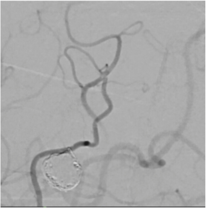 Figure 13