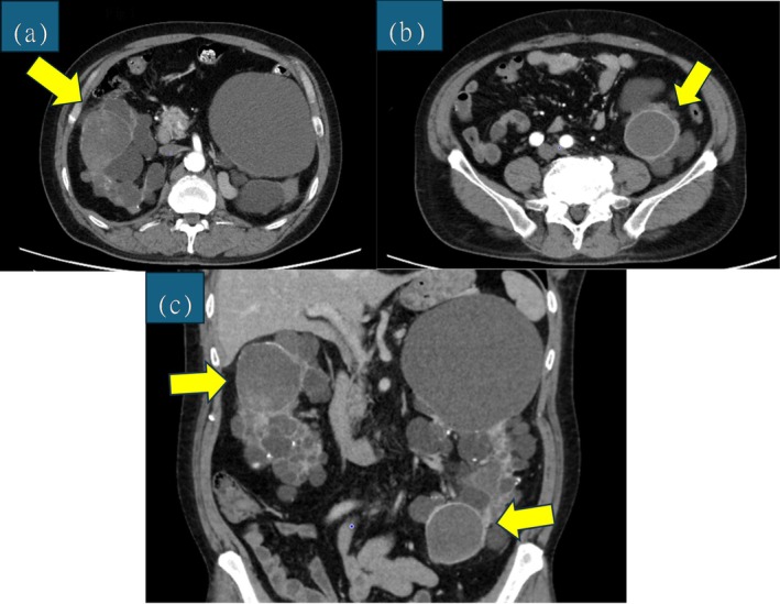 FIGURE 1
