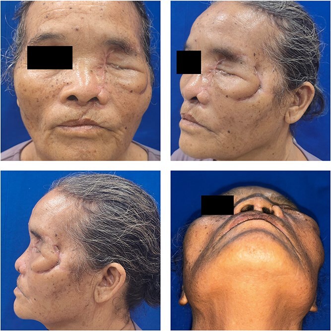 Figure 7