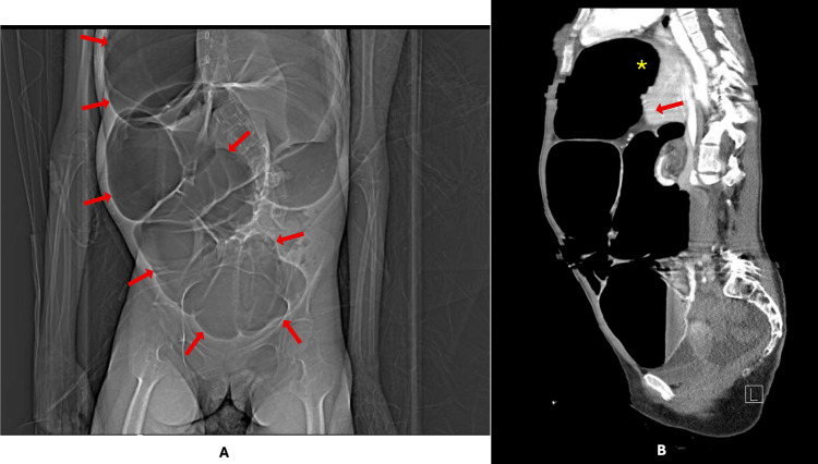 Figure 2