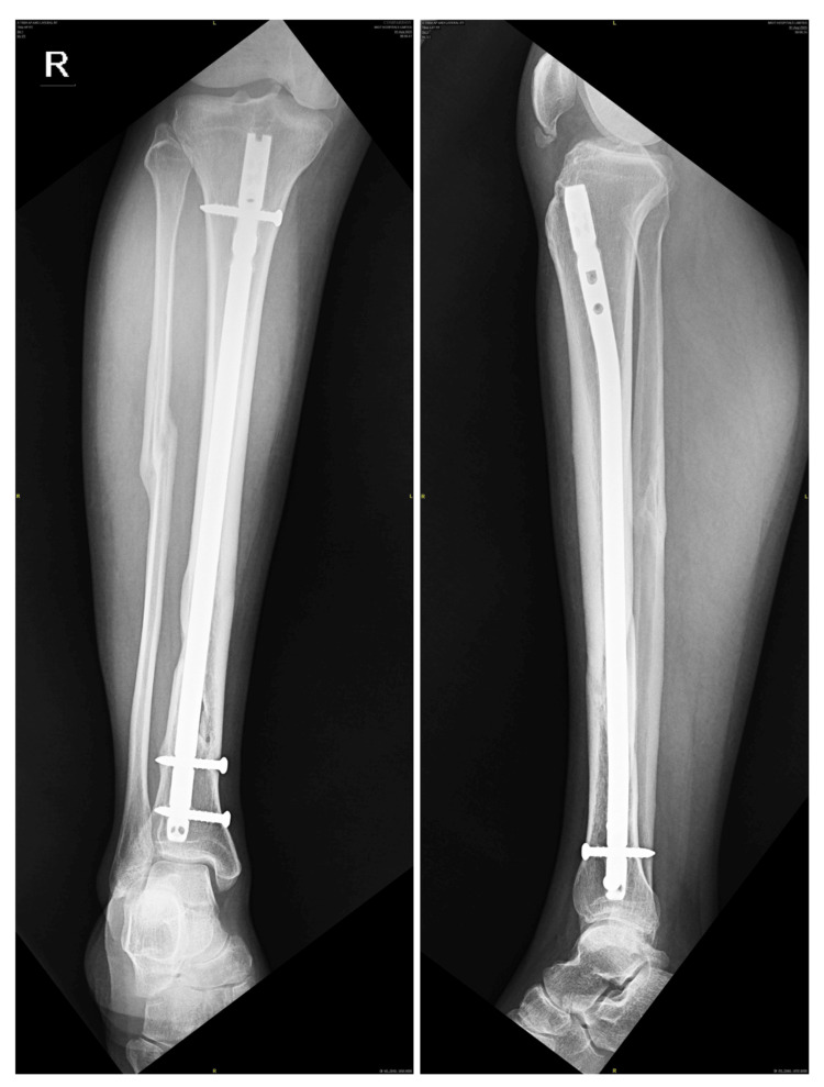 Figure 7