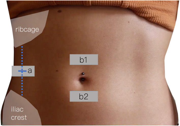 FIGURE 1