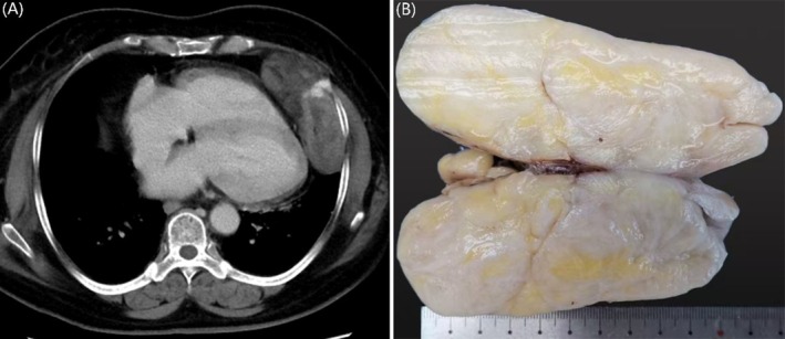 FIGURE 1