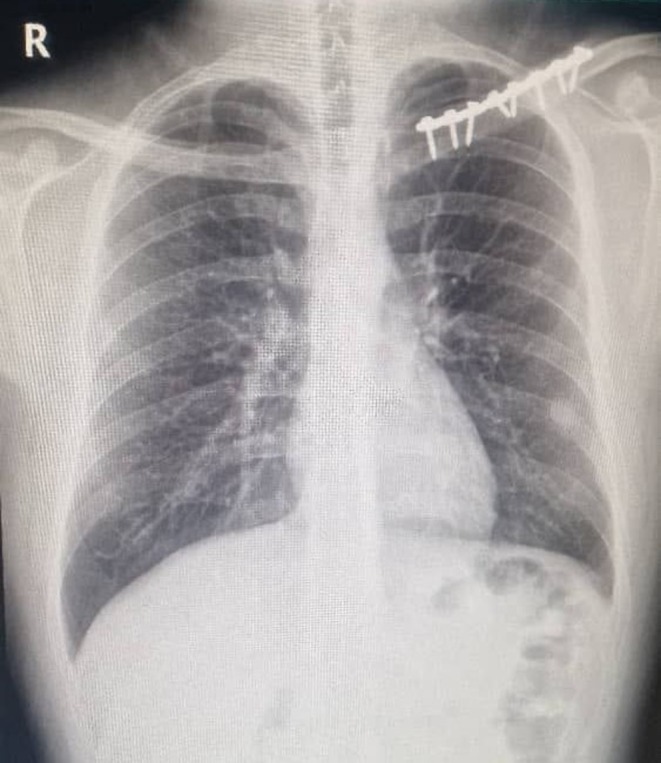 FIGURE 1