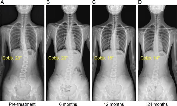 FIGURE 3