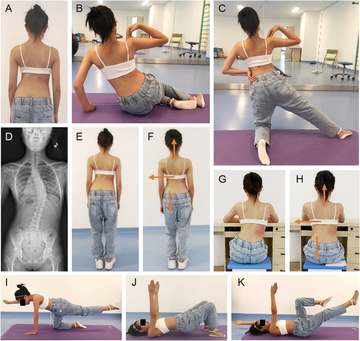 FIGURE 1