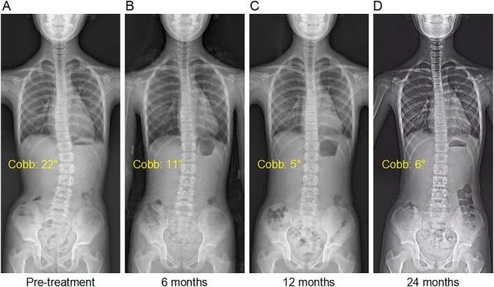 FIGURE 4