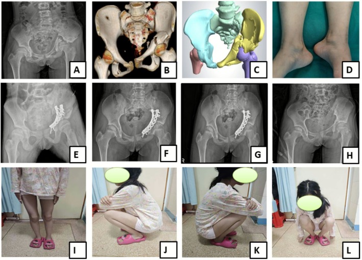 FIGURE 1