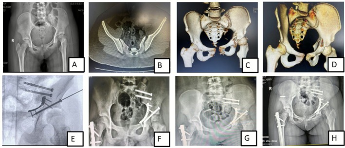 FIGURE 3