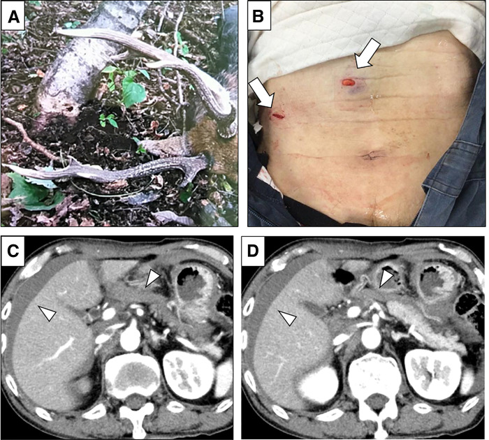 Fig. 1