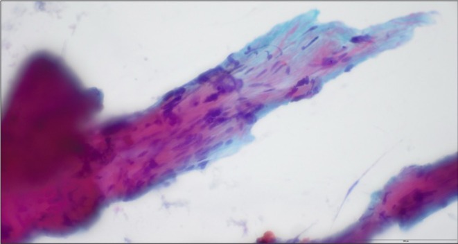 FIGURE 1