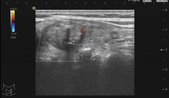 Figure 2