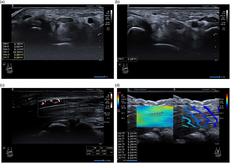 Figure 1