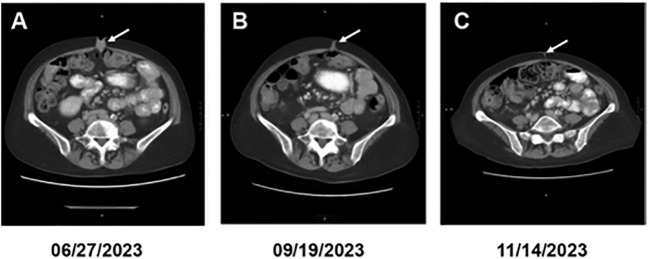 Figure 1