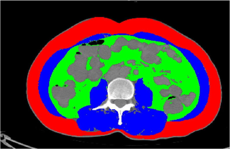Figure 2
