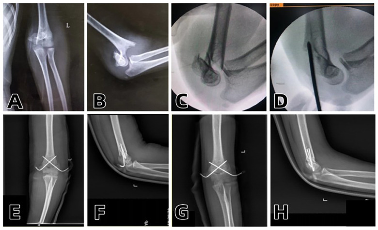 Figure 1