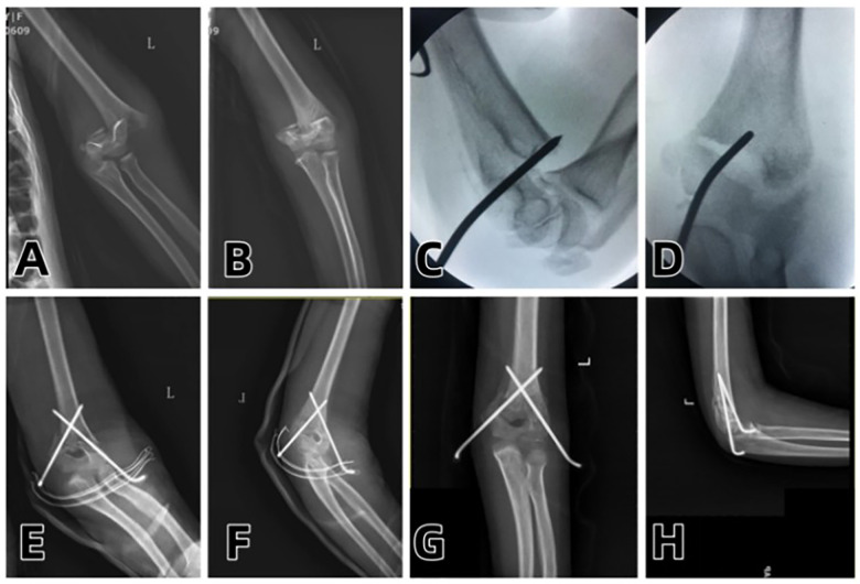 Figure 2